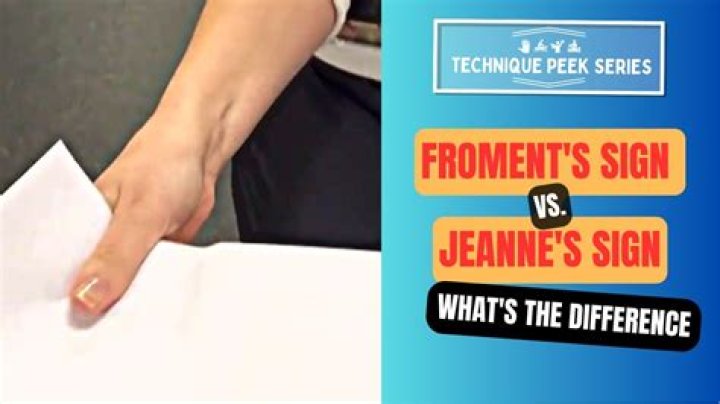 What is positive Froment sign?