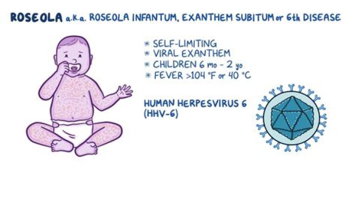 What is roseola infantum?