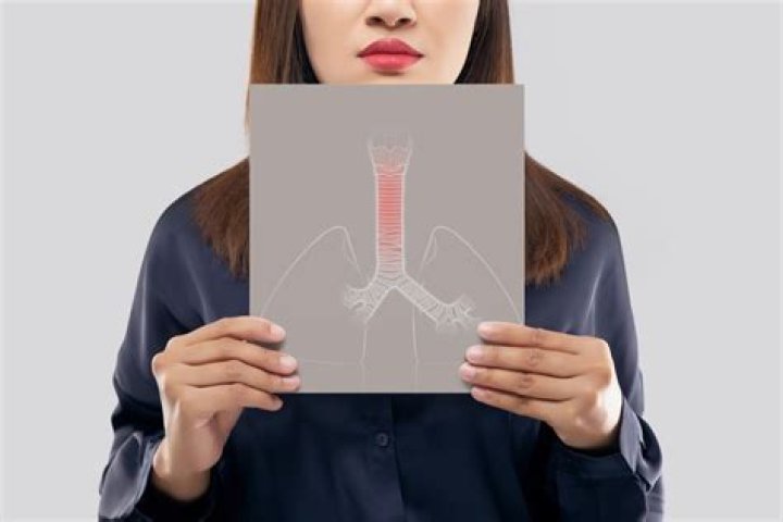 What is subglottic swelling?