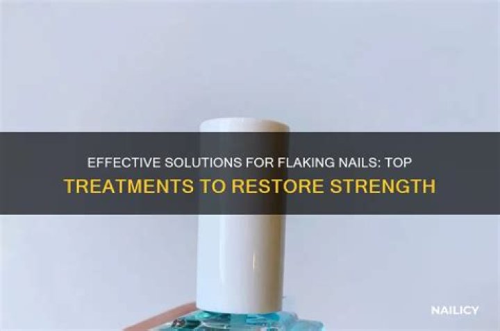 What is the best treatment for flaking nails?