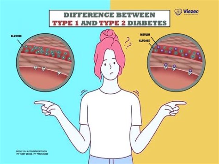 What is the difference between type 2a and type 2b construction?