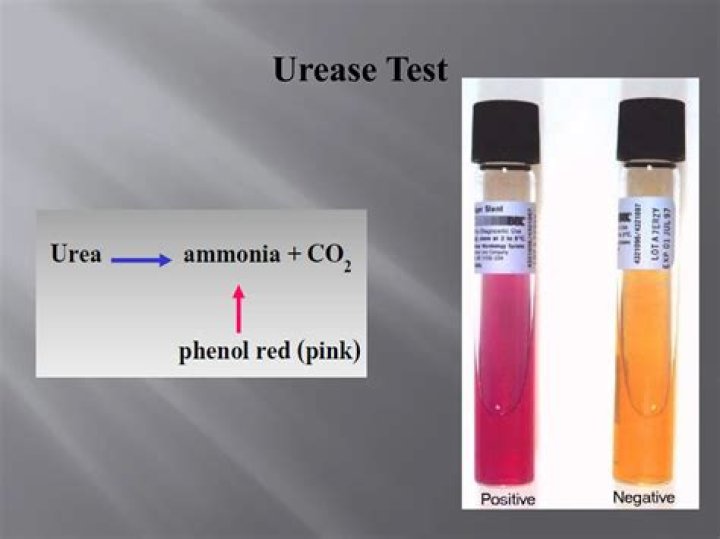 What is urease inhibition?
