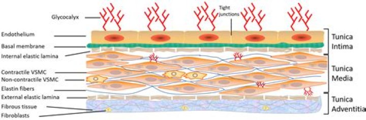 What is zonular instability?