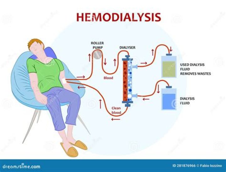 What labs are drawn at dialysis?