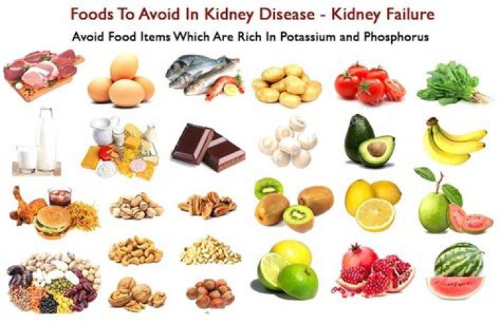 What should not eat in kidney stone?