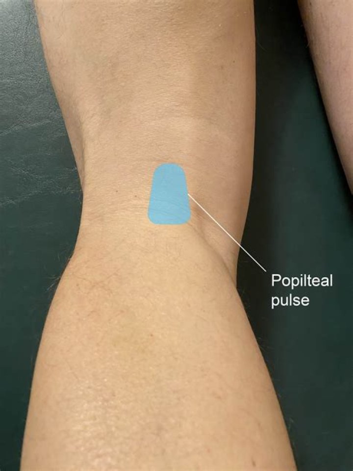 Where is the popliteal pulse located?