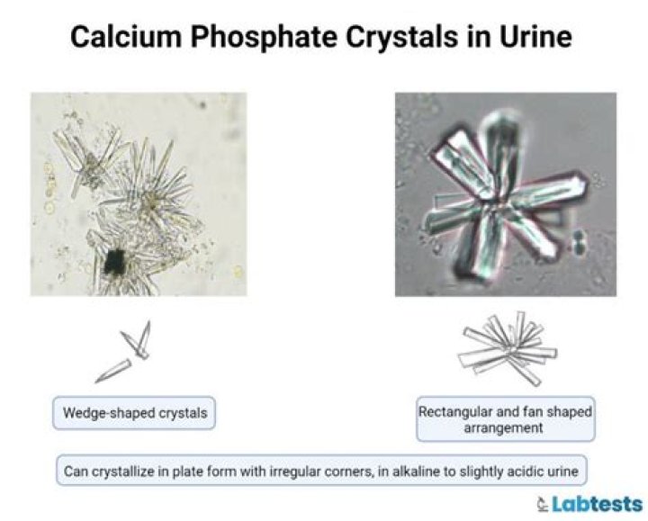 Which urine pH can calcium oxalates be seen?