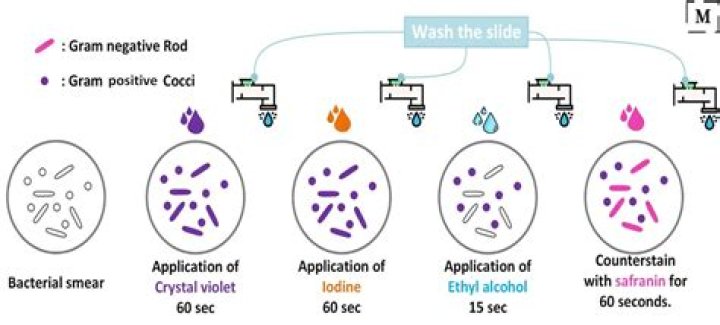 Why actin staining is done?