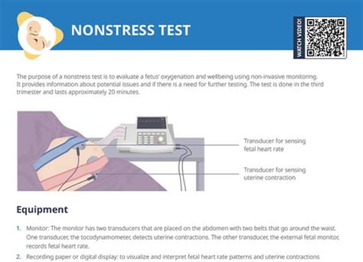 Why do they do a non-stress test twice a week?