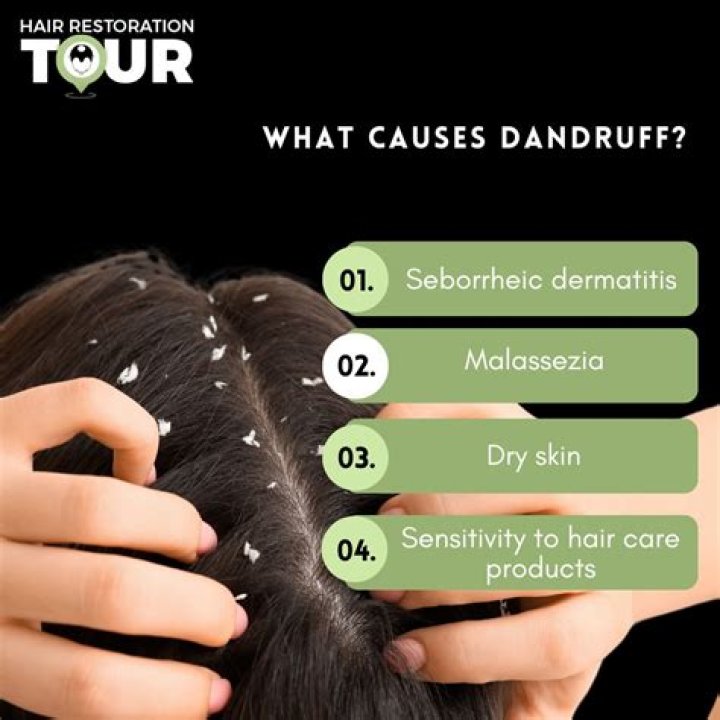 Why does my beagle have dandruff?