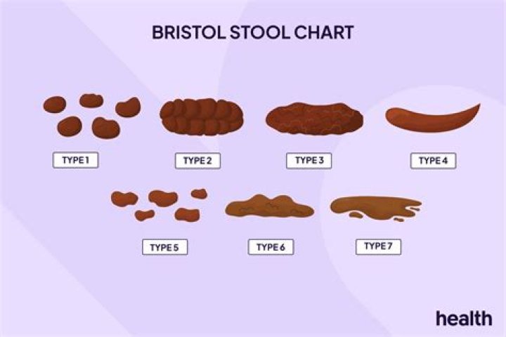 Why does my poop look like plastic?